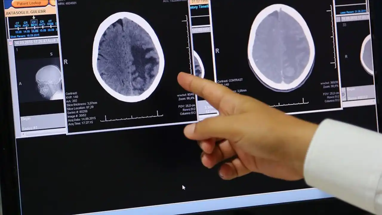 Umut vaat eden beyin implantları! haberinin görseli