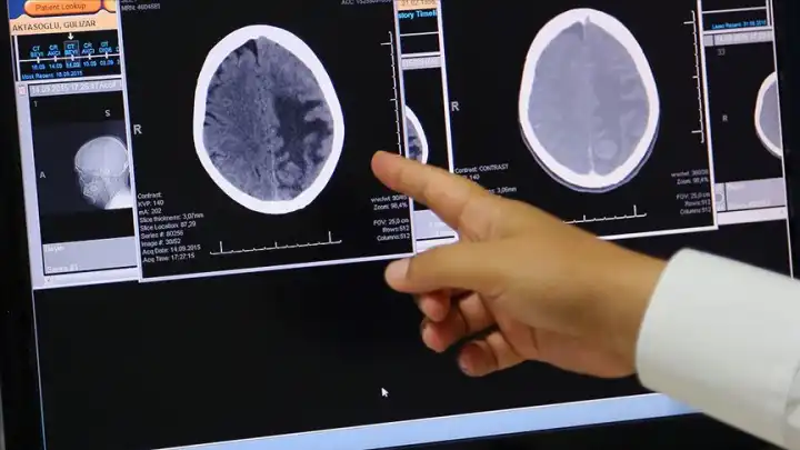 Umut vaat eden beyin implantları! haberinin görseli
